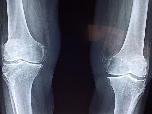 (사진=픽사베이)