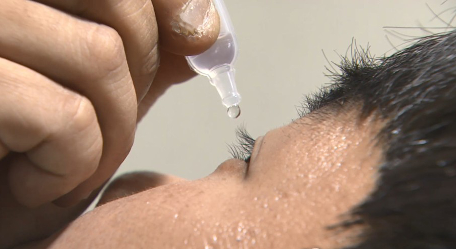 인공눈물 투약 장면. 연합뉴스