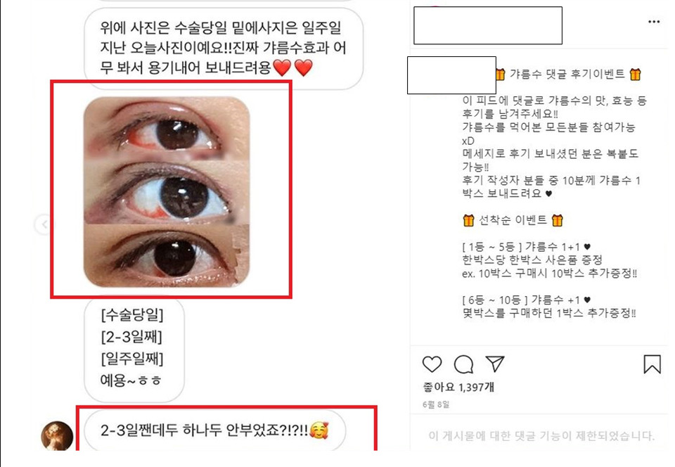 부기제거에 탁월하다며 과대광고한 체험기. 자료 식약처