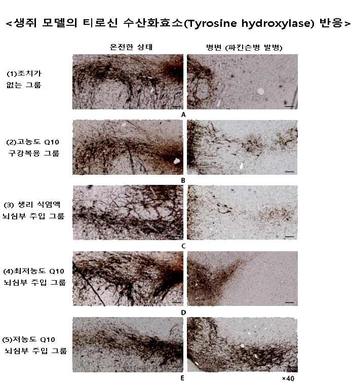 그룹별 온전한/병변 부위의 티로신 수산화효소 반응을 나타낸 그림. 티로신 수산화효소가 잘 관찰될수록, 도파민 신경세포 손상이 적음을 의미한다. 사진=서울대병원