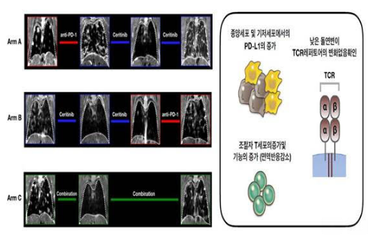 [그림 좌] 형질전환 마우스에서 면역항암제 후 ALK억제제(Arm A), ALK 억제제 이후 면역항암제(ArmB), ALK 억제제와 면역항암제 병합요법 (Arm C)의 폐 변화 영상. Arm A의 경우 면역항암제(anti-PD-1) 투여 후 폐암이 악화됐다. ALK 억제제(ceritinib) 투여 후에도 상황이 나아지지 않았다. Arm B의 경우 ALK 억제제 투여 후 증상이 호전됐지만 면역항암제 투여 후 상태가 나빠졌다. Arm C에서 면역항암제와 ALK 억제제를 병용한 결과 상황이 더 나빠진 것을 확인할 수 있다.​​​​​​​ [그림 우] ALK 폐암은 종양세포 및 기저세포에서 면역기능을 억제하는 PD-L1이 증가 돼 있다. 면역반응을 감소시키는 T조절 면역세포 역시 증가해 돌연변이 발생이 쉽다. 암세포 사멸에 관여하는 TCR 레퍼토어는 변화가 없었다. 사진=연세암병원