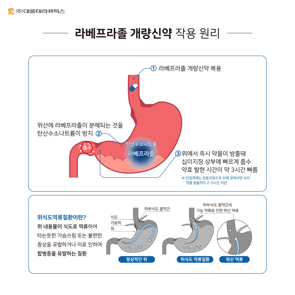 대웅테라퓨틱스는 국내 최초로 라베프라졸과 제산제를 결합해 약효 발현시간을 3시간 이상 앞당긴 새로운 위식도역류질환 치료제를 발매했다. [사진=대웅제약]