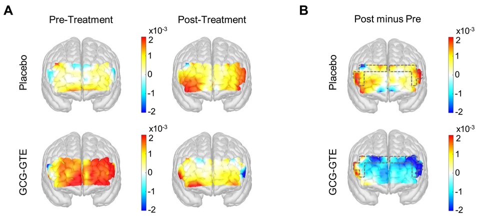 시험 수행 전후 뇌의 활성도, 에너지 소비 변화에 관한 논문 삽입 이미지 [사진=아모레퍼시픽] 